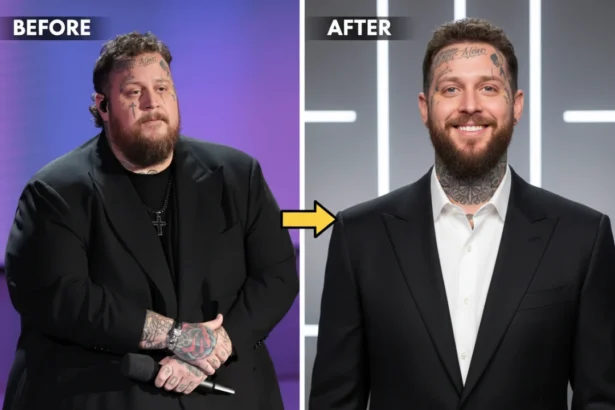 How Jelly Roll Lost Over 100 Pounds
